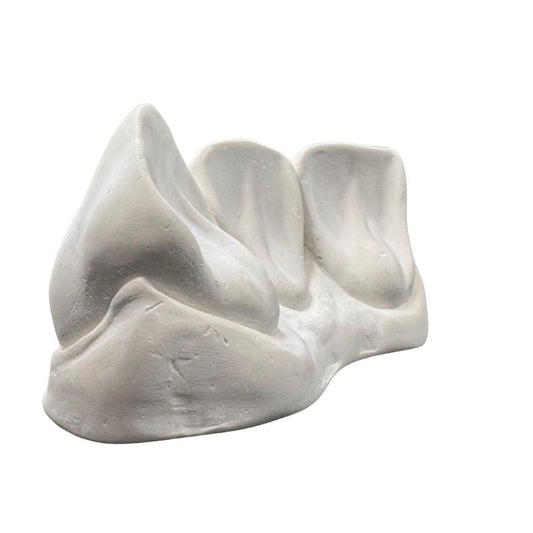 Macromodelos en yeso anteriores central, lateral y canino