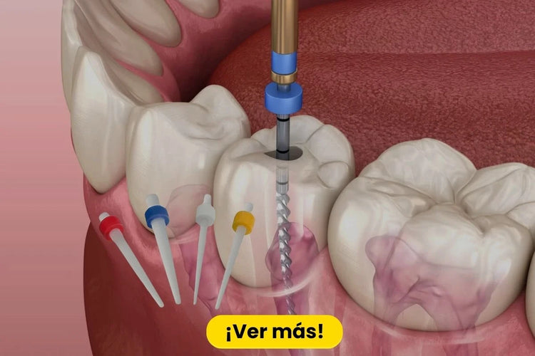suministros de endodoncia 