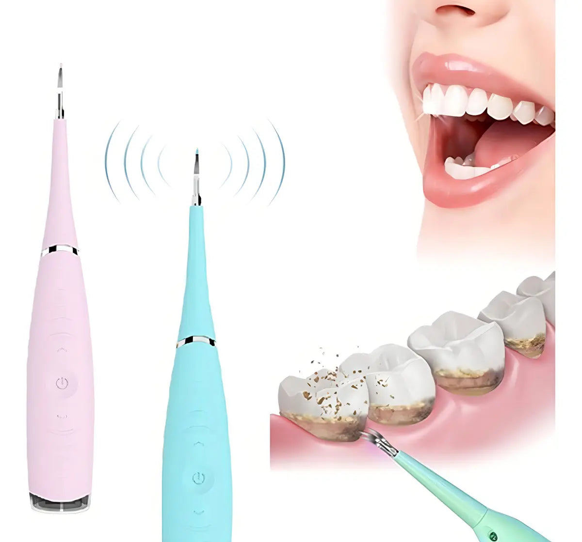 Removedor De Sarro Ultrasonico Para Dientes Limpios