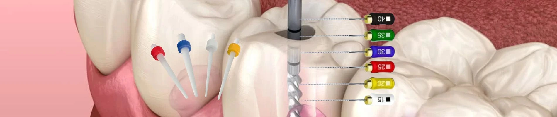 MATARIALES PARA ENDODONCIA