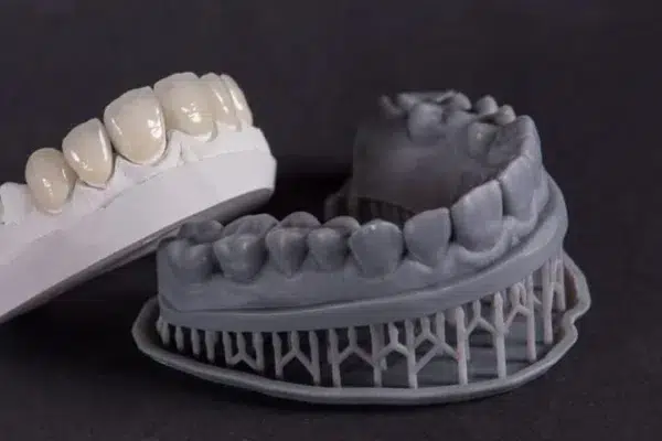 Cerámicas Dentales: Tipos y Aplicaciones en Prótesis Fija Moderna