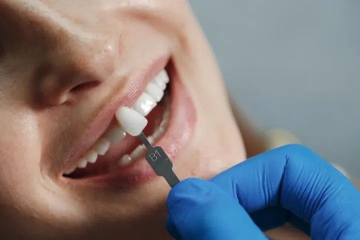 Resinas Dentales Fotopolimerizables: Guía Completa de Tipos y Aplicaciones