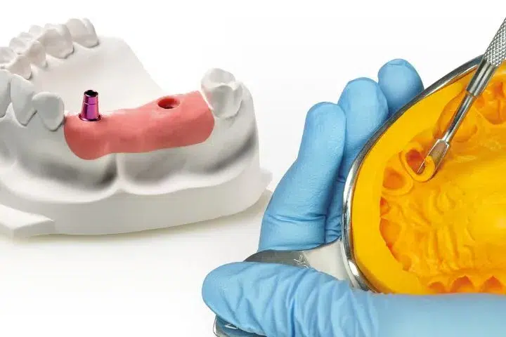 siliconas dentales por adición y condensación