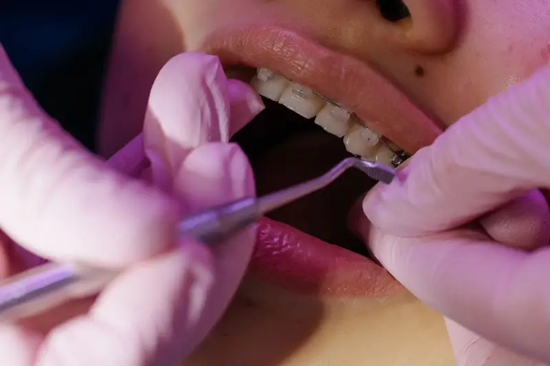 Insumos y Equipos Odontológicos en Pereira y Colombia 6 ortodoncia